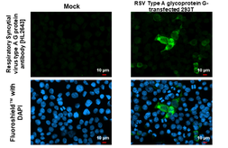 Anti-Respiratory Syncytial virus type A G protein antibody [HL2643] used in Immunocytochemistry/ Immunofluorescence (ICC/IF). GTX639099